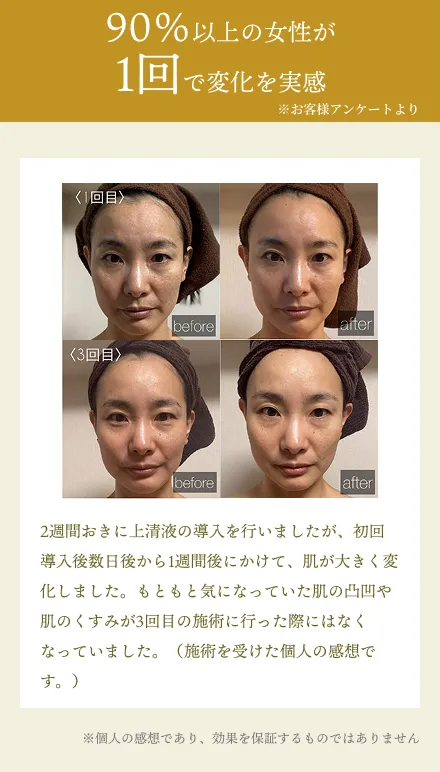 90％以上の女性が 1回で変化を実感